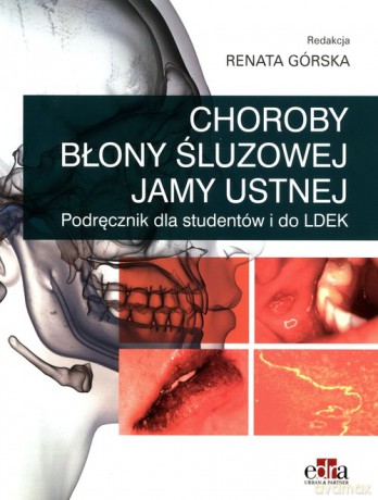 Choroby błony śluzowej jamy ustnej [KSIĄŻKA]