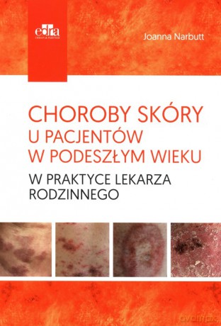 Choroby skóry u pacjentów w podeszłym wieku w praktyce lekarza rodzinnego - J. Narbutt [KSIĄŻKA]