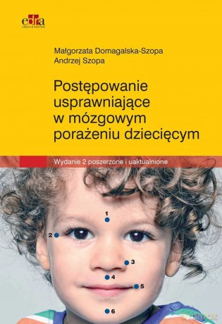Postępowanie usprawniające w mózgowym porażeniu dziecięcym - Małgorzata Domagalska-Szopa, Andrzej Szopa [KSIĄŻKA]