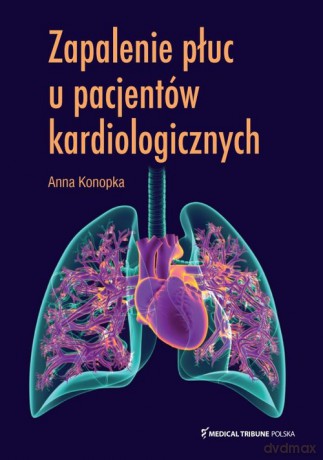 Zapalenie płuc u pacjentów kardiologicznych - Anna Konopka [KSIĄŻKA]