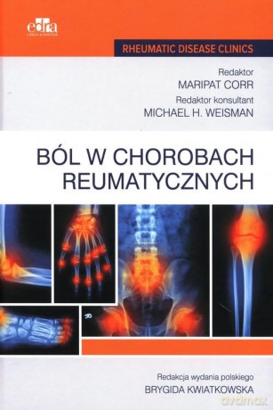 Ból w chorobach reumatycznych - M. Corr [KSIĄŻKA]
