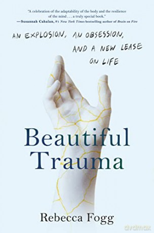 Beautiful Trauma - Rebecca Fogg [KSIĄŻKA]