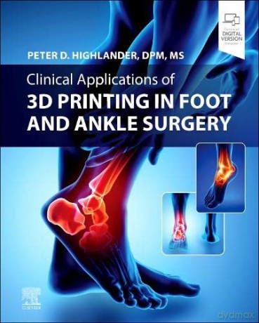 Clinical Applications Of 3d Printing In - Peter D. Highlander DPM MS [KSIĄŻKA]