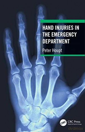 Hand Injuries In The Emergency Departmen - Peter Houpt [KSIĄŻKA]
