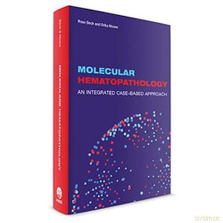 Molecular Hematopathology - Rose C. Beck [KSIĄŻKA]