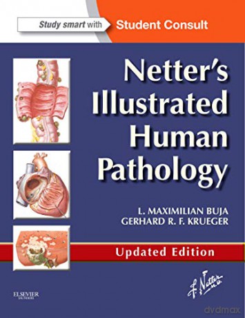 Netter S Illustrated Human Pathology Up - L. Maximilian Buja MD [KSIĄŻKA]