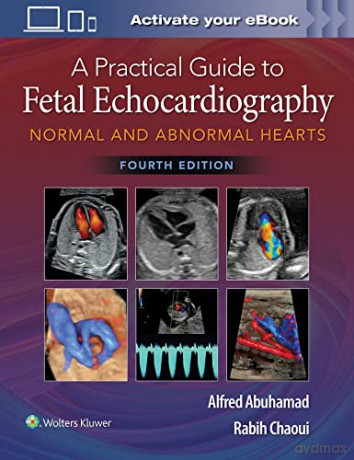 Practical Guide To Fetal Echocardiograph - Alfred Z. Abuhamad [KSIĄŻKA]