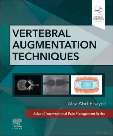 Vertebral Augmentation Techniques - Alaa Abd-Elsayed MD MPH FASA [KSIĄŻKA]