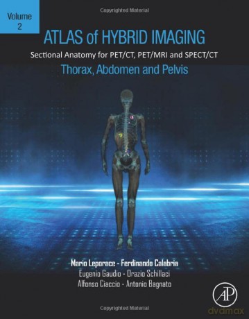 Atlas of Hybrid Imaging Sectional Anatomy for PET/CT, PET/MRI and SPECT/CT Vol. 2: Thorax Abdomen and Pelvis: Sectional Anatomy for PET/CT, PET/MRI and SPECT/CT - Mario Leporace [KSIĄŻKA]