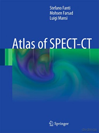 Atlas Of Spectct - Stefano Fanti [KSIĄŻKA]