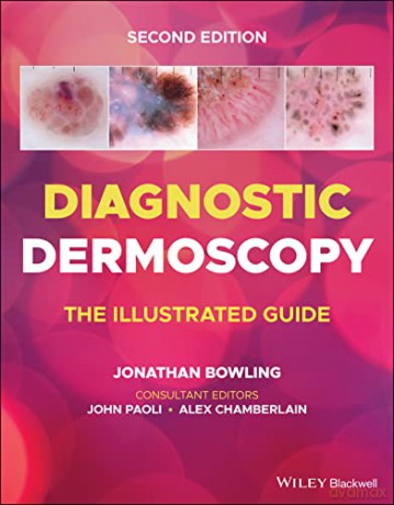Diagnostic Dermoscopy The Illus - Jonathan Bowling [KSIĄŻKA]