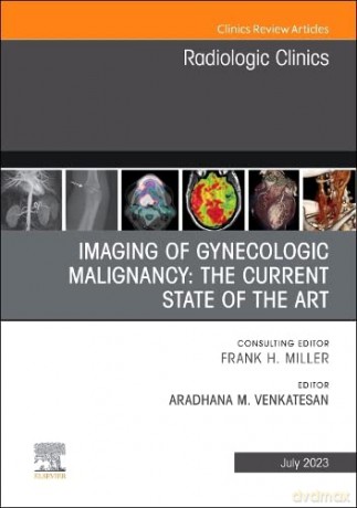 Imaging of Gynecologic Malignancy: The Current State of the Art, An Issue of Radiologic Clinics of North America (Volume 61-4) (The Clinics: Radiology, Volume 61-4) - Aradhana M. Venkatesan MD [KSIĄŻKA]
