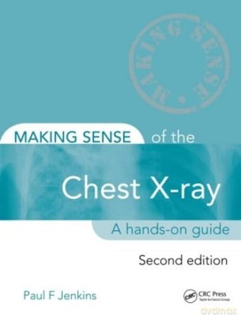 Making Sense of the Chest X-ray: A hands-on guide - Paul Jenkins [KSIĄŻKA]