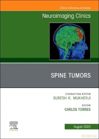 MRI and Traumatic Brain Injury, An Issue of Neuroimaging Clinics of North America (Volume 33-2) (The Clinics: Radiology, Volume 33-2) - Pejman Jabehdar Maralani [KSIĄŻKA]
