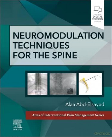 Neuromodulation Techniques for the Spine: A Volume in the Atlas of Interventional Pain Management Series - Alaa Abd-Elsayed MD MPH FASA [KSIĄŻKA]