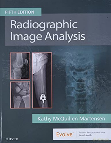 Radiographic Image Analysis [KSIĄŻKA]