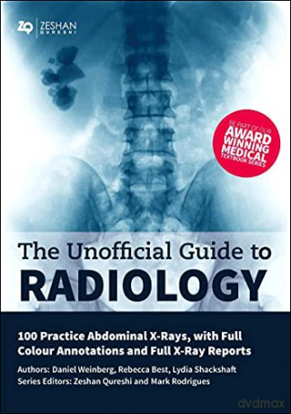 Unofficial Gde Radiology 100 Pract Abd [KSIĄŻKA]