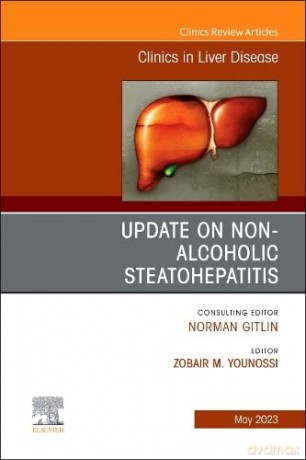 Update on Non-Alcoholic Steatohepatitis, An Issue of Clinics in Liver Disease (Volume 27-2) (The Clinics: Internal Medicine, Volume 27-2) - Zobair M. Younossi MD MPH FACP FACG AGAF FAASLD [KSIĄŻKA]