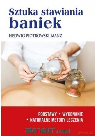 Sztuka stawiania baniek. Podstawy, wykonanie - Hedwig Piotrowski-Manz [KSIĄŻKA]
