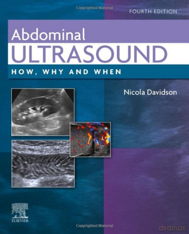 Abdominal Ultrasound: How, Why and When - Nicola Davidson [KSIĄŻKA]