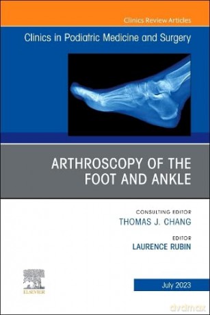 Arthroscopy of the Foot and Ankle, An Issue of Clinics in Podiatric Medicine and Surgery - Laurence Rubin [KSIĄŻKA]