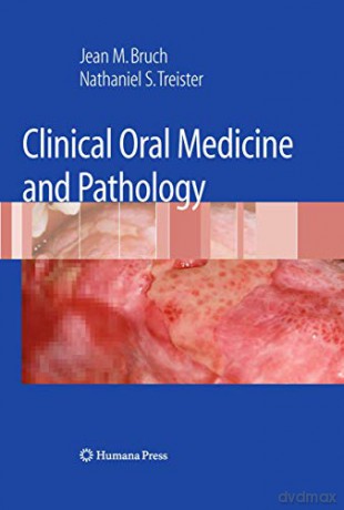 Clinical Oral Medicine and Pathology - Bruch [KSIĄŻKA]