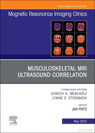 Musculoskeletal MRI Ultrasound Correlation, An Issue of Magnetic Resonance Imaging Clinics of North America - Jan Fritz [KSIĄŻKA]
