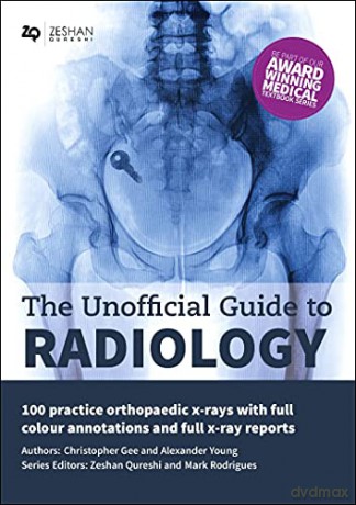 The Unofficial Guide to Radiology: 100 Practice Orthopaedic X Rays with Full Colour Annotations and Full X Ray Reports - Alexander Young [KSIĄŻKA]