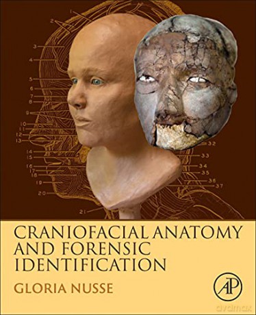 Craniofacial Anatomy and Forensic Identification - Gloria Nusse [KSIĄŻKA]