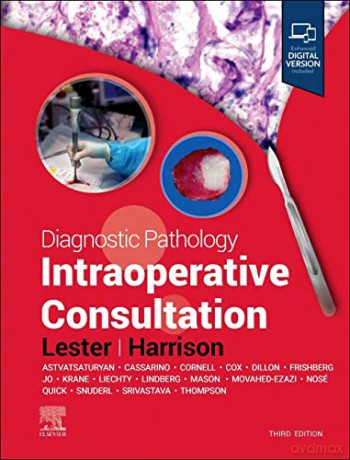 Diagnostic Pathology: Intraoperative Consultation - Beth T. Harrison MD [KSIĄŻKA]
