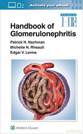 Handbook of Glomerulonephritis - Michelle Rheault [KSIĄŻKA]