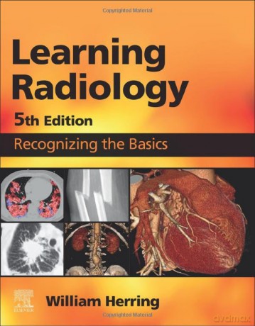 Learning Radiology: Recognizing the Basics - William Herring MD FACR [KSIĄŻKA]