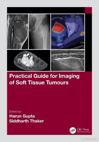 Practical Guide for Imaging of Soft Tissue Tumours - Harun Gupta [KSIĄŻKA]