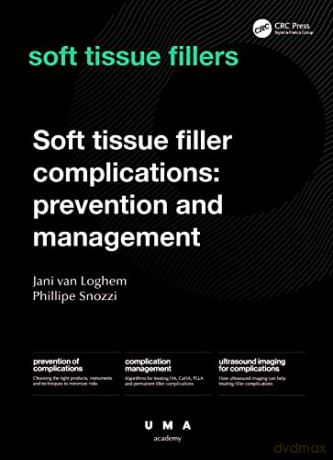 Soft Tissue Filler Complications: Prevention and Management - Jani van Loghem [KSIĄŻKA]