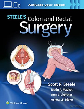 Steele's Colon and Rectal Surgery - Scott Steele [KSIĄŻKA]