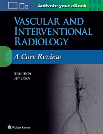 Vascular and Interventional Radiology: A Core Review - Jeffrey Elbich [KSIĄŻKA]