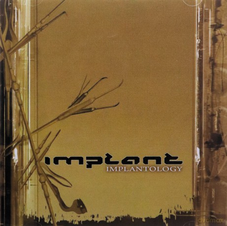 Implant: Implantology [CD]