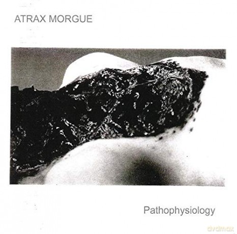 Atrax Morgue: Pathophysiology [CD]