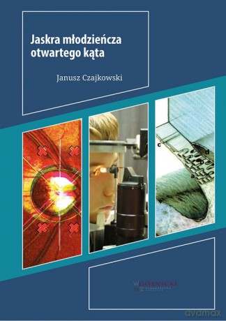 Jaskra młodzieńcza otwartego kąta - Janusz Czajkowski [KSIĄŻKA]
