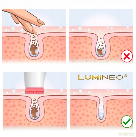 Szczoteczka do twarzy model 868 różowa + żel blemish 100 ml Lumineo