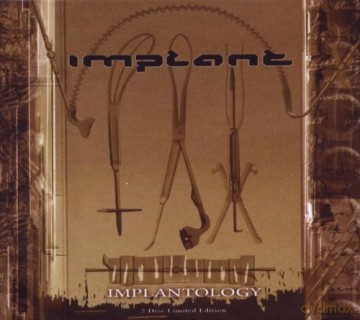 Implant: Implantology (limited) [2CD]