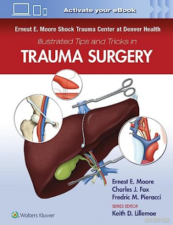 Harborview Illus Tip Trick Acute Care [KSIĄŻKA]