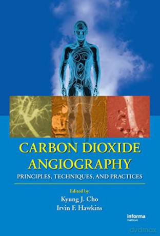 Carbon Dioxide Angiography - Kyung Cho [KSIĄŻKA]