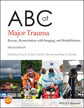 Abc Of Major Trauma [KSIĄŻKA]