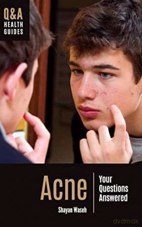 Acne: Your Questions Answered - Shayan Waseh [KSIĄŻKA]