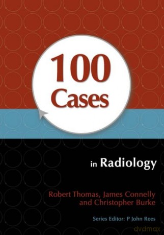 100 Cases In Radiology - Robert Et Al Thomas [KSIĄŻKA]
