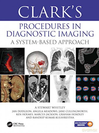 Clarks Diagnostic Imaging Procedures - A. Stewart Whitley [KSIĄŻKA]