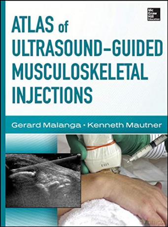 Atlas Of Ultrasound Guided Musculo - Gerard Malanga [KSIĄŻKA]