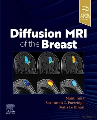 Diffusion Mri Of The Breast - Mami Iima [KSIĄŻKA]