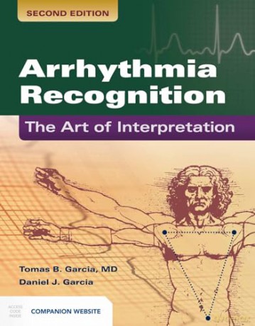Arrhythmia Recognition - Garcia [KSIĄŻKA]